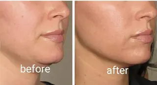 aliaハイフ&水光ジェットサロン所属・aliaハーブ水光店 エステティシャン募集のエステ・リラクイメージ