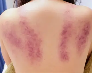 initium所属・清澄白河 initiumのエステ・リラクイメージ