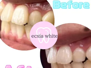 セルフホワイトニングサロン　エクシアホワイト西尾店所属・エクシアホワイト西尾 堀内恵のその他イメージ