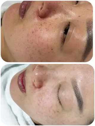 エムズ ビューティスタジオのエステ・リラクイメージ