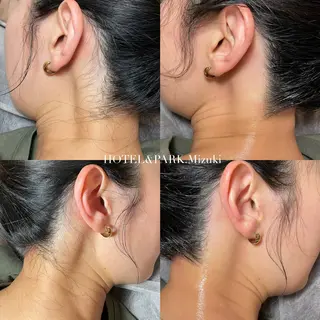 HOTEL&PARK . ワックス脱毛のエステ・リラクイメージ