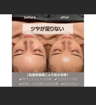 Moana【モアナ】 HIROのエステ・リラクイメージ