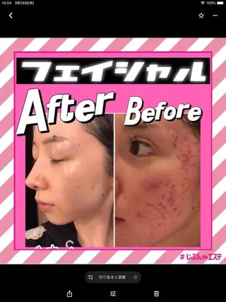 じぶんdeエステ 博多マルイ店所属・じぶんdeエステ 博多マルイ店のエステ・リラクイメージ