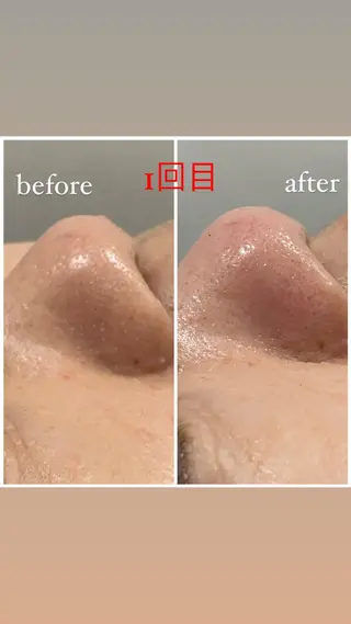 アルカンジュ~archange~所属・痩身/毛穴洗浄/脱毛 アルカンジュのエステ・リラクイメージ