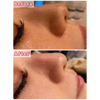 ハーブピーリング専門 muro.のエステ・リラクイメージ