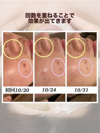 ベルーテ エッセンスのエステ・リラクイメージ