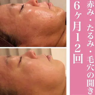 ミディアム カラー パーマ ヘアアレンジ メンズ キッズ ネイル マツエク・マツパ ニキビ・肌質改善専門 ♡人生が変わるサロンのエステ・リラクイメージ