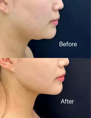 韓国式肌管理＆毛穴洗浄　THE ONE栄店所属・Theone 福本のエステ・リラクイメージ