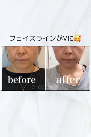 小顔と ヘッドスパのお店のエステ・リラクイメージ