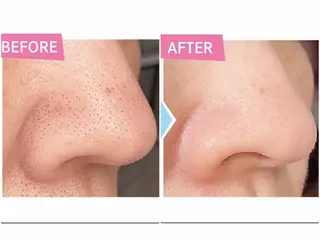 VIOTERACE トータルビューティーのエステ・リラクイメージ