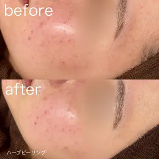 lulularico Yuのエステ・リラクイメージ