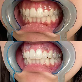 R E O T I A R A（レオティアラ）所属・高屋 昌子のその他イメージ