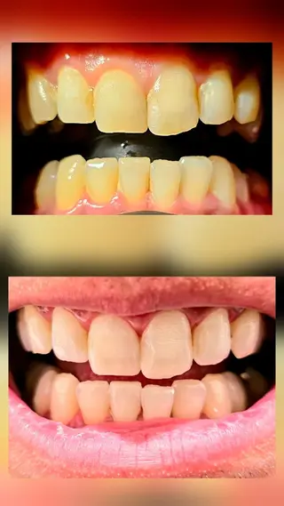 歯科提携セルフダック 宇都宮駒生店のエステ・リラクイメージ