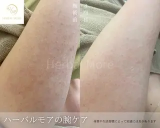 脱毛・眉毛・フェイス サロンN久留米店のその他イメージ