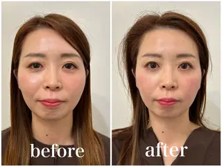 美容鍼＆鍼灸サロン 鍼Glitter.所属・田中 美奈のエステ・リラクイメージ