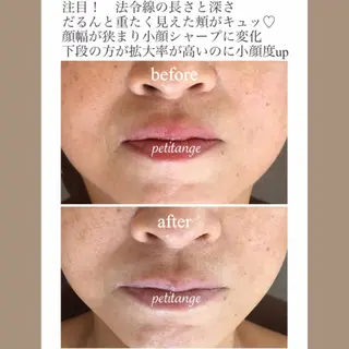 プチアンジェ所属・艶肌&小顔リフト❤︎ プチアンジェ茅ヶ崎のエステ・リラクイメージ