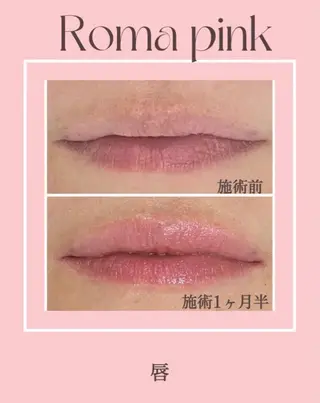 LiLL by Andre beauty所属・LiLL 熊本のエステ・リラクイメージ