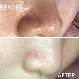 肌質改善エステ chiffonのエステ・リラクイメージ