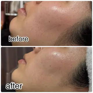 ROR Akariのエステ・リラクイメージ