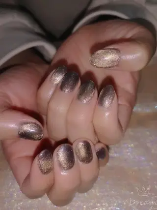 ネイル フィルイン、長さ出し 深爪矯正のネイルデザイン