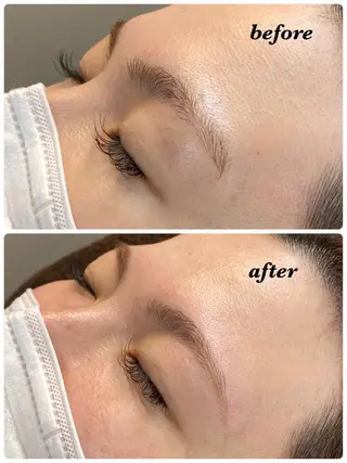 アイブロウ ハーブピーリング/韓国肌管理/フェイシャル/毛穴洗浄/眉毛/顔脱毛【糸脱毛専門】rev所属・ハーブピーリング🌹 毛穴洗浄❤️眉waxのエステ・リラクイメージ