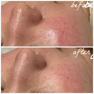 メンズ メナード岐阜市茜部 杉浦のエステ・リラクイメージ