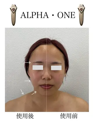 beauty salon arce所属・beauty salon arceのエステ・リラクイメージ