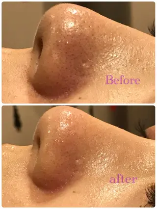 サロンドプララン所属・サロンド プラランのエステ・リラクイメージ