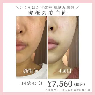 コガオファクトリー 北24条店のエステ・リラクイメージ