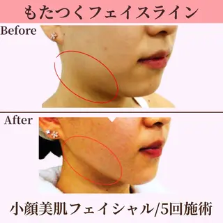 Belle White所属・本格痩身＊透明美肌 BelleWhiteのエステ・リラクイメージ