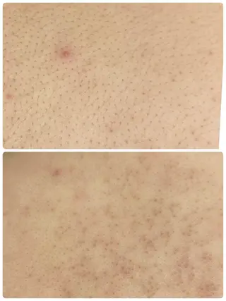 シュガーリングサロン ダリア所属・Dahliaダリア シュガーリングサロンのエステ・リラクイメージ