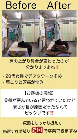 肩こり頭痛さようなら 整体カタギリのエステ・リラクイメージ