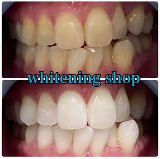 ホワイトニング ショップ吉祥寺店のエステ・リラクイメージ