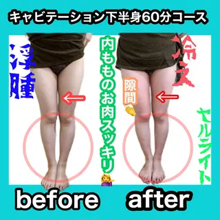 痩身/脱毛/ネイル HARUKAのエステ・リラクイメージ