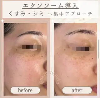 🎀韓国式肌改善🎀 Miku🇰🇷💎のその他イメージ