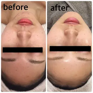 美肌脱毛・ハーブピーリング専門店Larin la beaute所属・Larin la beauteのエステ・リラクイメージ