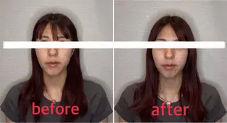 小林整骨院本町 美容鍼roomのエステ・リラクイメージ