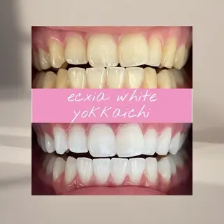 エクシア四日市所属・みそ エクシア四日市のエステ・リラクイメージ