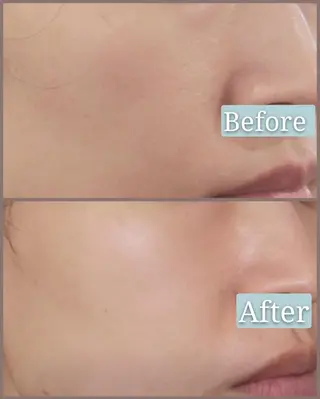 🅖🅤🅩🅔🅛 salonのエステ・リラクイメージ