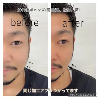 ENCHANT 脱毛.小顔.毛穴のエステ・リラクイメージ