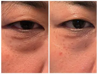 ブラジリアンWAX❥ /脂肪ケアsalonのエステ・リラクイメージ