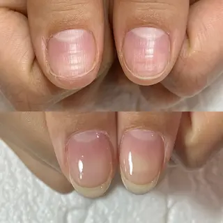 ネイル 自爪育成・巻き爪 補正講師　津蔵のネイルデザイン