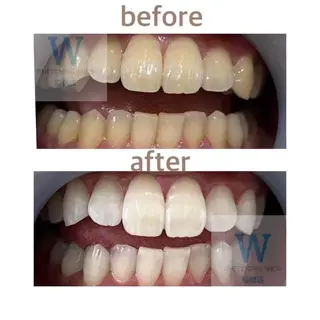 ホワイトニング ショップ船橋店🦷のエステ・リラクイメージ