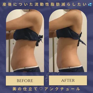 ﾌﾟﾗｲﾍﾞｰﾄｻﾛﾝ アンクチュール所属・UnCouture 〜アンクチュール〜のエステ・リラクイメージ