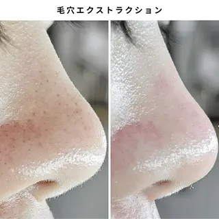 Muqu.所属・Muqu. 毛穴サロンのエステ・リラクイメージ