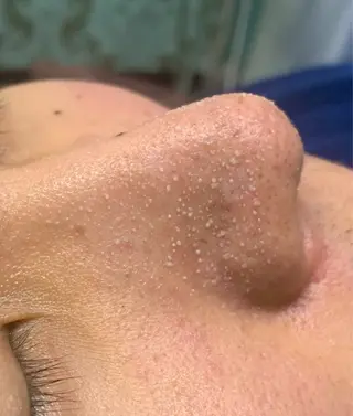 フェイシャル/脱毛 ジョアアンジェ　田中のエステ・リラクイメージ