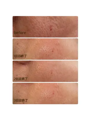 温活美肌専門サロン Lien『リアン』のエステ・リラクイメージ