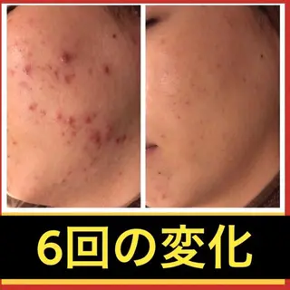 ショート カラー パーマ ヘアアレンジ メンズ ネイル マツエク・マツパ ニキビ・肌質改善専門 ♡人生が変わるサロンのエステ・リラクイメージ