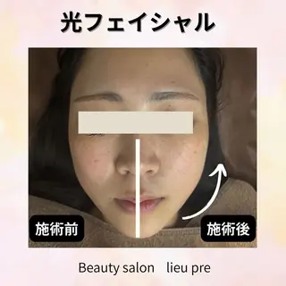 lieupré 脱毛 oshima‎⌣̈のエステ・リラクイメージ