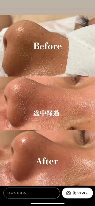 Banyan miyukiのエステ・リラクイメージ